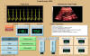 Javascript /TypeScript real-time graphics tools Fetal Monitor